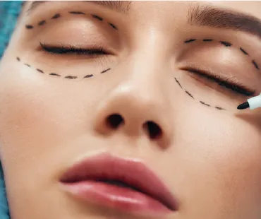 okuloplastychna-khirurhiia